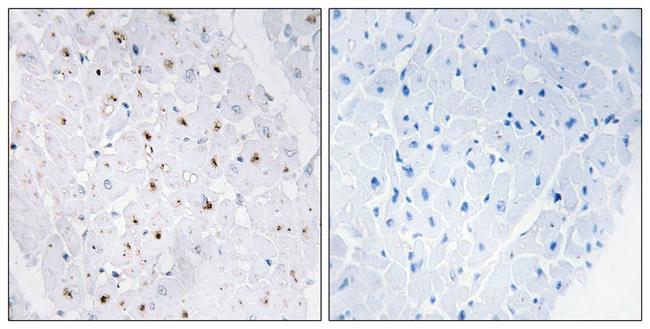 Phospho-Blooms Syndrome (Thr99) Antibody in Immunohistochemistry (Paraffin) (IHC (P))