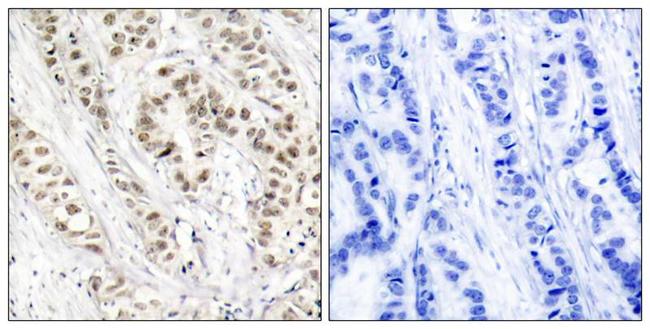 Phospho-BRCA1 (Ser1524) Antibody in Immunohistochemistry (Paraffin) (IHC (P))