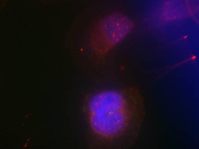 Phospho-BRCA1 (Ser988) Antibody in Immunocytochemistry (ICC/IF)