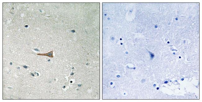 Phospho-MCK10 (Tyr513) Antibody in Immunohistochemistry (Paraffin) (IHC (P))