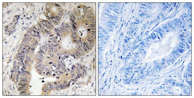 Phospho-CAD (Thr456) Antibody in Immunohistochemistry (Paraffin) (IHC (P))