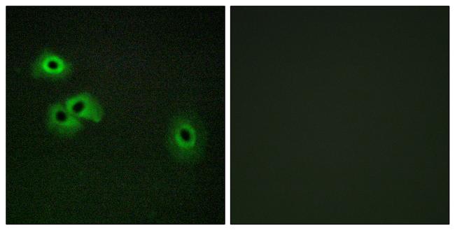 Phospho-Calmodulin (Thr79, Ser81) Antibody in Immunocytochemistry (ICC/IF)