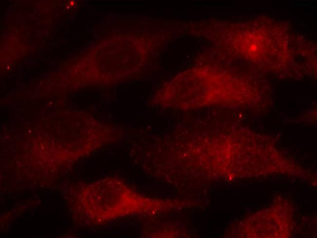 Phospho-Caveolin 1 (Tyr14) Antibody in Immunocytochemistry (ICC/IF)