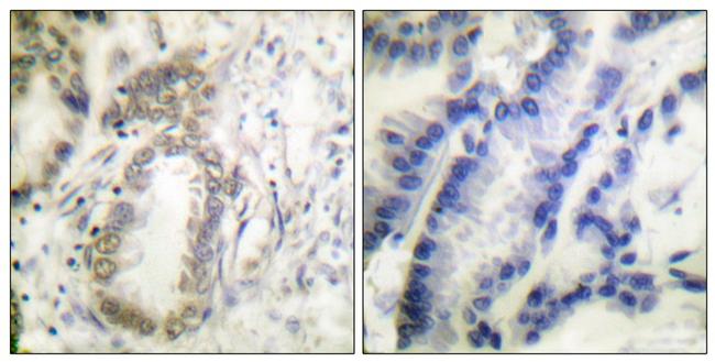 Phospho-C/EBP alpha (Ser21) Antibody in Immunohistochemistry (Paraffin) (IHC (P))