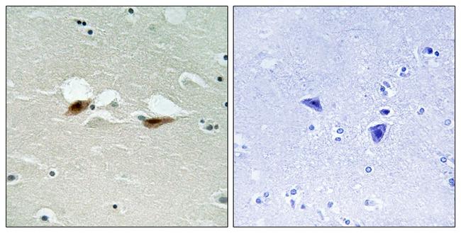 Phospho-ATF2 (Ser472) Antibody in Immunohistochemistry (Paraffin) (IHC (P))