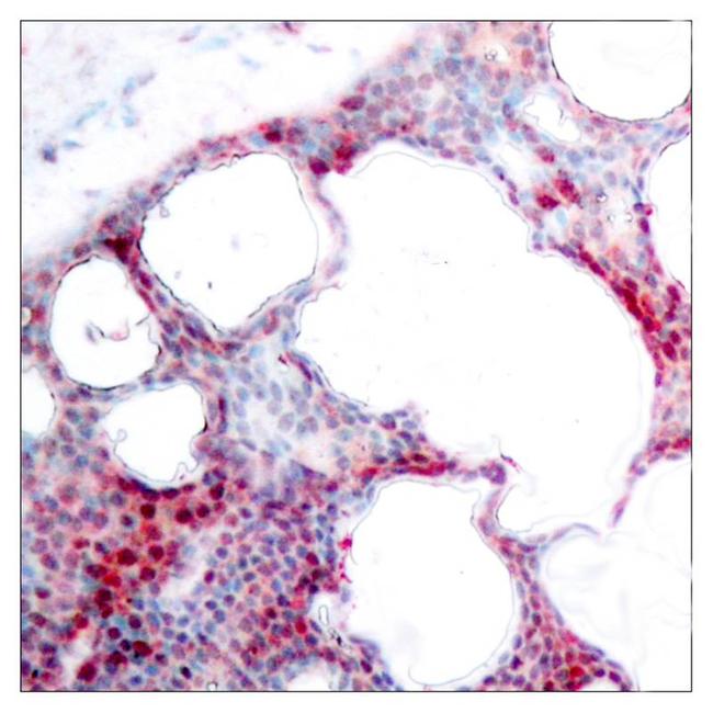 Phospho-ATF2 (Ser44, Ser62) Antibody in Immunohistochemistry (Paraffin) (IHC (P))