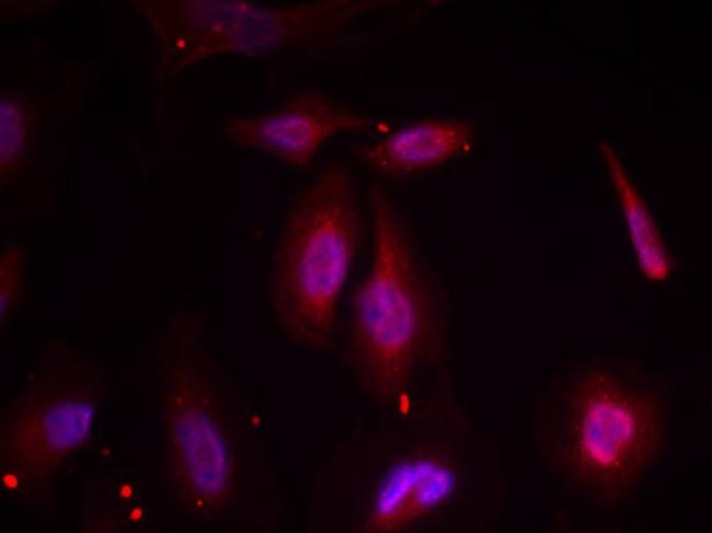 Phospho-ATF2 (Thr51, Thr69) Antibody in Immunocytochemistry (ICC/IF)