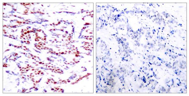 Phospho-ATF2 (Thr53, Thr71) Antibody in Immunohistochemistry (Paraffin) (IHC (P))