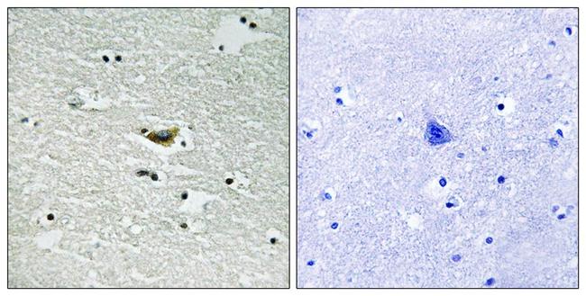 Phospho-CK1 alpha (Tyr294) Antibody in Immunohistochemistry (Paraffin) (IHC (P))