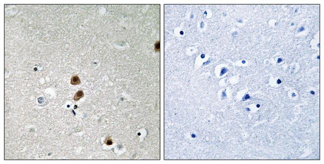 Phospho-CtBP1 (Ser422) Antibody in Immunohistochemistry (Paraffin) (IHC (P))