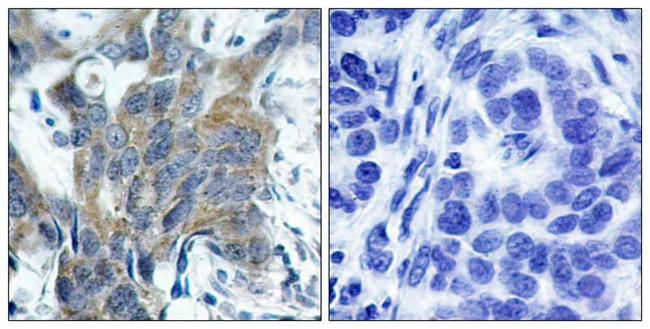 Phospho-beta Catenin (Ser33) Antibody in Immunohistochemistry (Paraffin) (IHC (P))