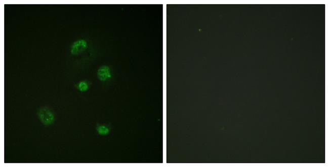 Phospho-CHOP (Ser30) Antibody in Immunocytochemistry (ICC/IF)