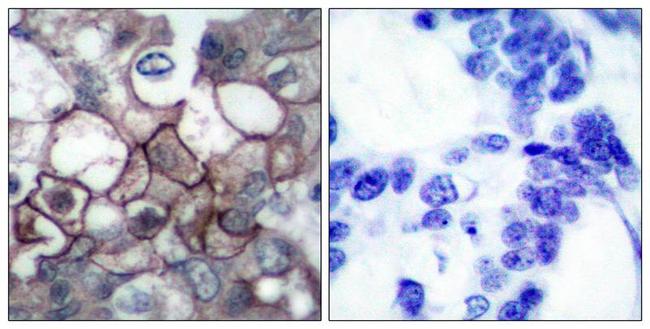 Phospho-EGFR (Tyr1197) Antibody in Immunohistochemistry (Paraffin) (IHC (P))