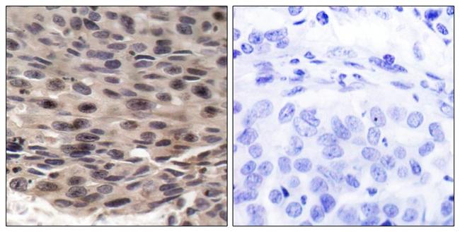 Phospho-4EBP1 (Thr37) Antibody in Immunohistochemistry (Paraffin) (IHC (P))