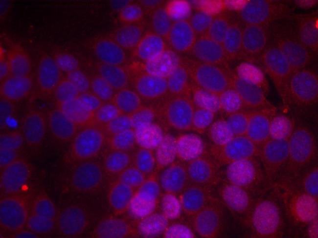 Phospho-Estrogen Receptor alpha (Ser106) Antibody in Immunocytochemistry (ICC/IF)