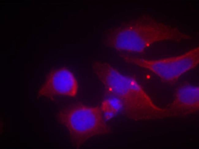 Phospho-NMDAR2B (Tyr1474) Antibody in Immunocytochemistry (ICC/IF)