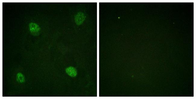 Phospho-hnRNP D (Ser83) Antibody in Immunocytochemistry (ICC/IF)