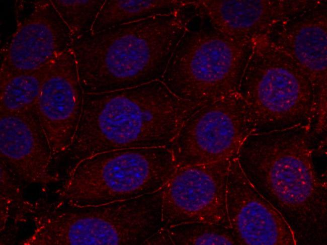 Phospho-IGF1R beta (Tyr1161) Antibody in Immunocytochemistry (ICC/IF)