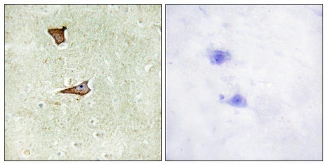 Phospho-IGF2R (Ser2409) Antibody in Immunohistochemistry (Paraffin) (IHC (P))