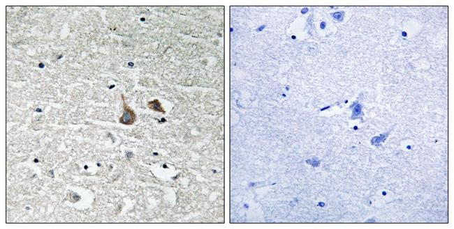 Phospho-IRAK1 (Ser376) Antibody in Immunohistochemistry (Paraffin) (IHC (P))