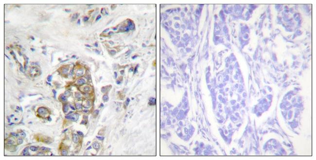 Phospho-CD104 (Tyr1510) Antibody in Immunohistochemistry (Paraffin) (IHC (P))