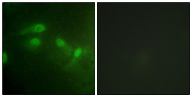 Phospho-MDM2 (Ser186, Ser188) Antibody in Immunocytochemistry (ICC/IF)