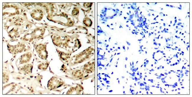 Phospho-MEF2A (Ser408) Antibody in Immunohistochemistry (Paraffin) (IHC (P))