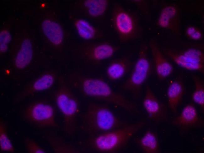 Phospho-MEF2A (Thr312) Antibody in Immunocytochemistry (ICC/IF)