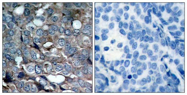 Phospho-ASK1 (Ser83) Antibody in Immunohistochemistry (Paraffin) (IHC (P))