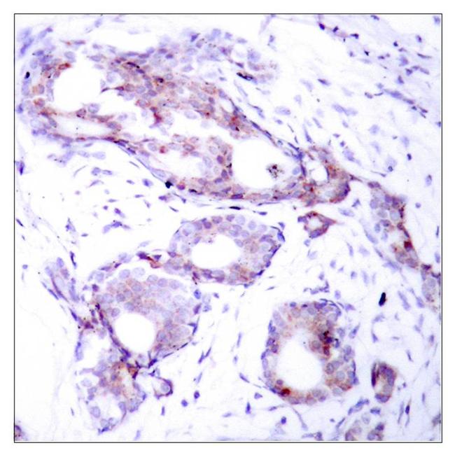 Phospho-c-Myc (Ser373) Antibody in Immunohistochemistry (Paraffin) (IHC (P))