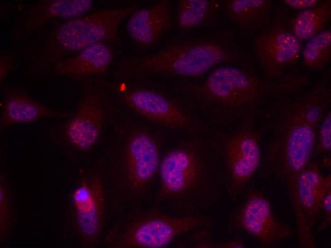 Phospho-c-Myc (Thr358) Antibody in Immunocytochemistry (ICC/IF)