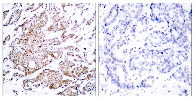 Phospho-c-Myc (Thr58) Antibody in Immunohistochemistry (Paraffin) (IHC (P))