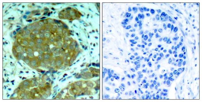 Phospho-NFkB p105 (Ser932) Antibody in Immunohistochemistry (Paraffin) (IHC (P))