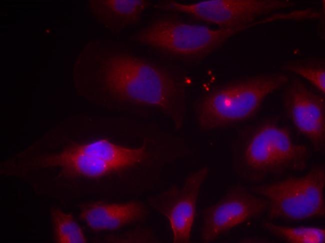 Phospho-NFkB p100 (Ser870) Antibody in Immunocytochemistry (ICC/IF)