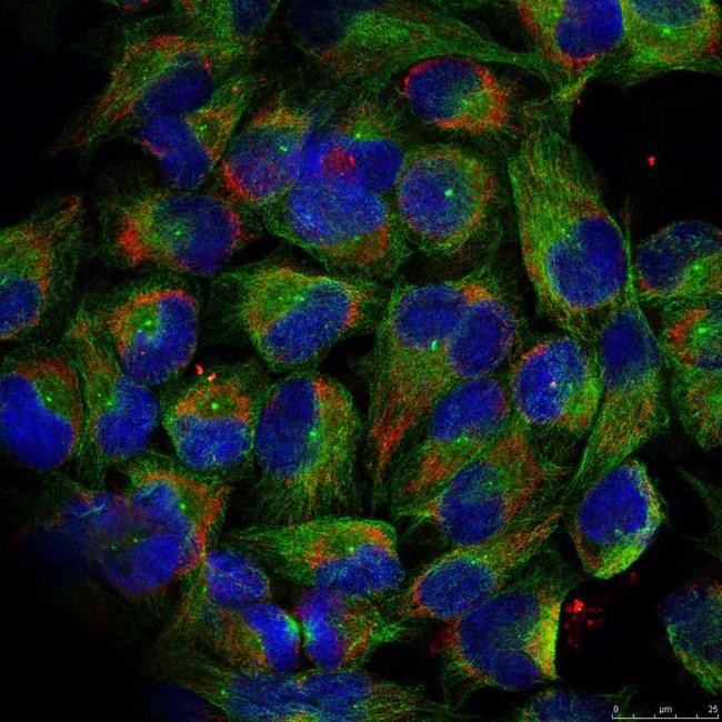 Phospho-NFkB p100 (Ser866) Antibody in Immunocytochemistry (ICC/IF)