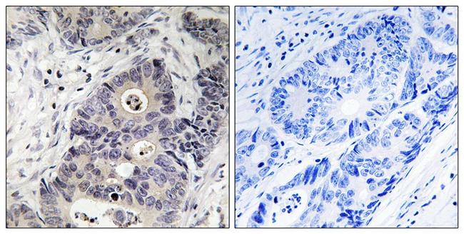 Phospho-iNOS (Tyr151) Antibody in Immunohistochemistry (Paraffin) (IHC (P))