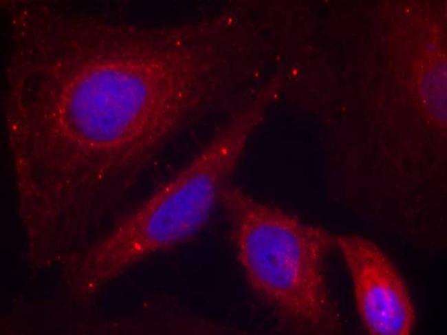 Phospho-PAK1 (Thr212) Antibody in Immunocytochemistry (ICC/IF)