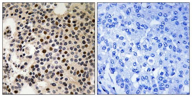 Phospho-PAK2 (Ser197) Antibody in Immunohistochemistry (Paraffin) (IHC (P))