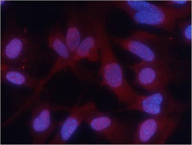 Phospho-PKM2 (Ser37) Antibody in Immunocytochemistry (ICC/IF)