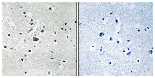 Phospho-PLD2 (Tyr169) Antibody in Immunohistochemistry (Paraffin) (IHC (P))