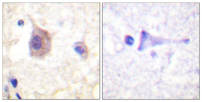 Phospho-PKC mu (Tyr463) Antibody in Immunohistochemistry (Paraffin) (IHC (P))