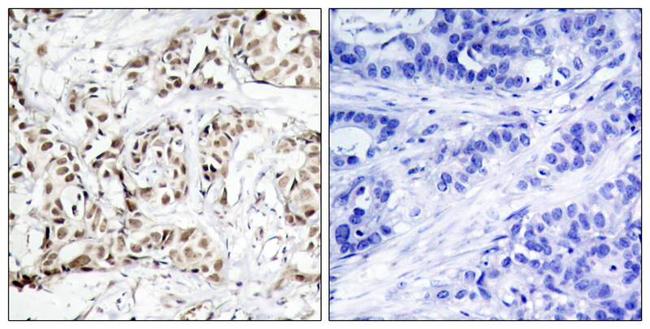 Phospho-JNK1 (Thr183) Antibody in Immunohistochemistry (Paraffin) (IHC (P))