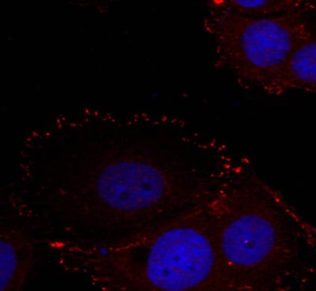 Phospho-FAK (Tyr576, Tyr577) Antibody in Immunocytochemistry (ICC/IF)