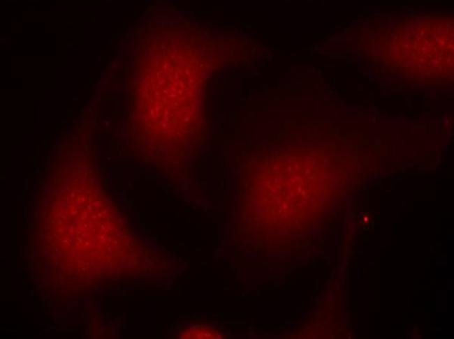 Phospho-Rb (Ser795) Antibody in Immunocytochemistry (ICC/IF)