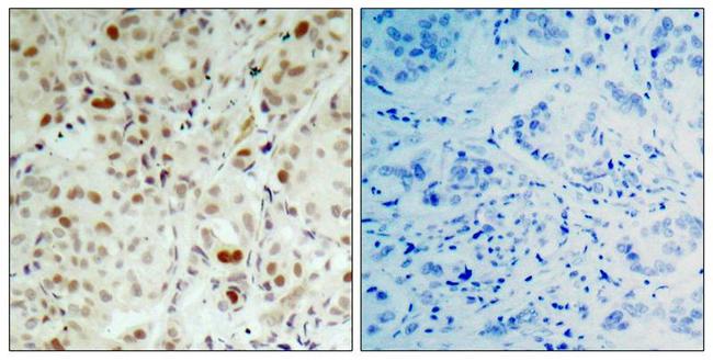 Phospho-Rb (Ser807) Antibody in Immunohistochemistry (Paraffin) (IHC (P))