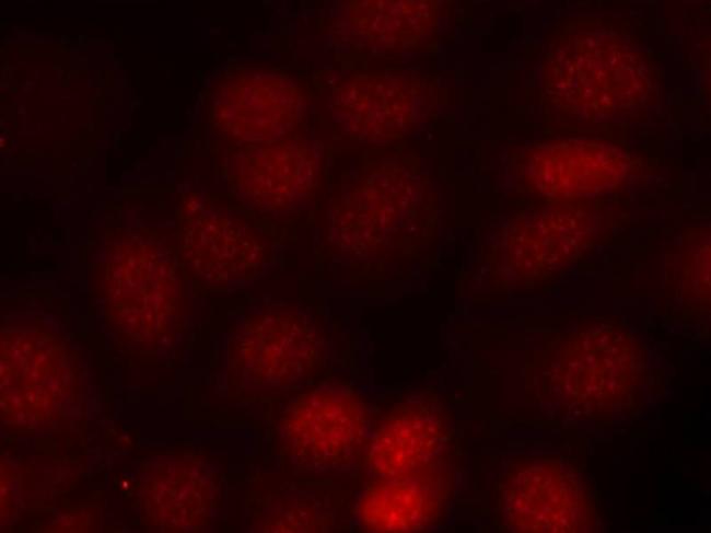 Phospho-p70 S6 Kinase (Thr421) Antibody in Immunocytochemistry (ICC/IF)