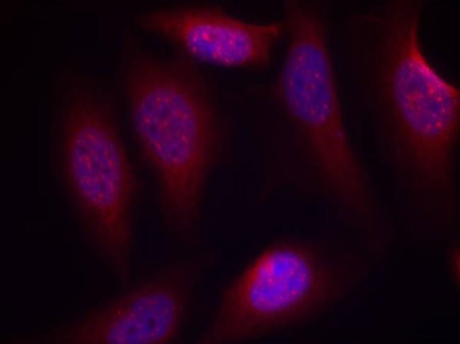 Phospho-MAP2K4 (Ser80) Antibody in Immunocytochemistry (ICC/IF)