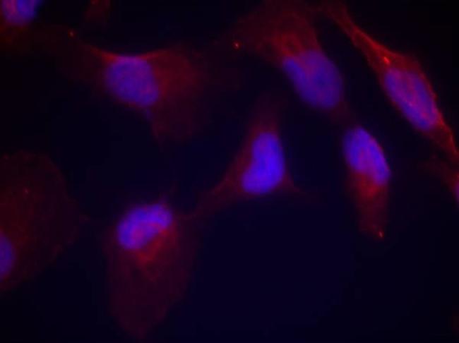 Phospho-MAP2K4 (Thr261) Antibody in Immunocytochemistry (ICC/IF)