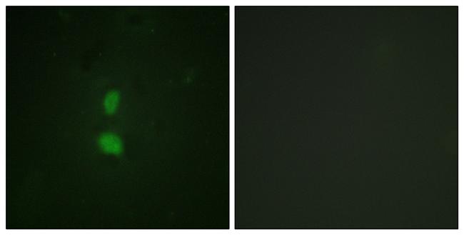 Phospho-SNAIL (Ser246) Antibody in Immunocytochemistry (ICC/IF)