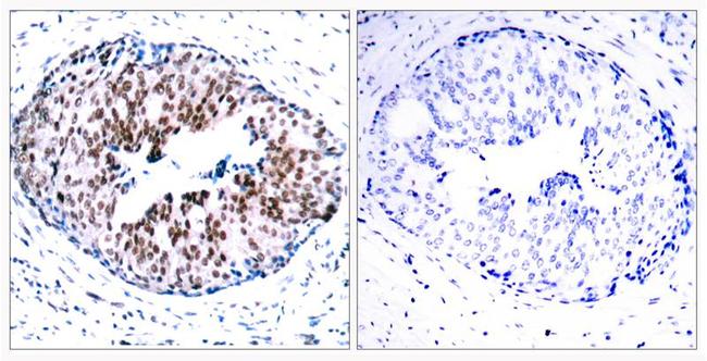 Phospho-STAT5 alpha (Ser780) Antibody in Immunohistochemistry (Paraffin) (IHC (P))